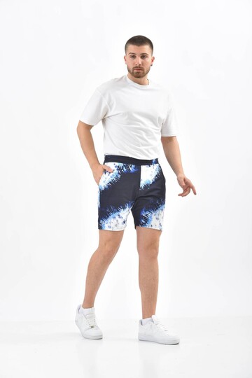 Navy Blue Tie-Dye Patterned Elastic Waist Shorts